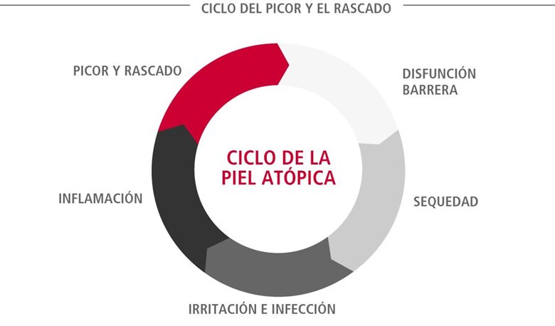El ciclo atópico de la piel (también conocido como el ciclo de la picazón)
